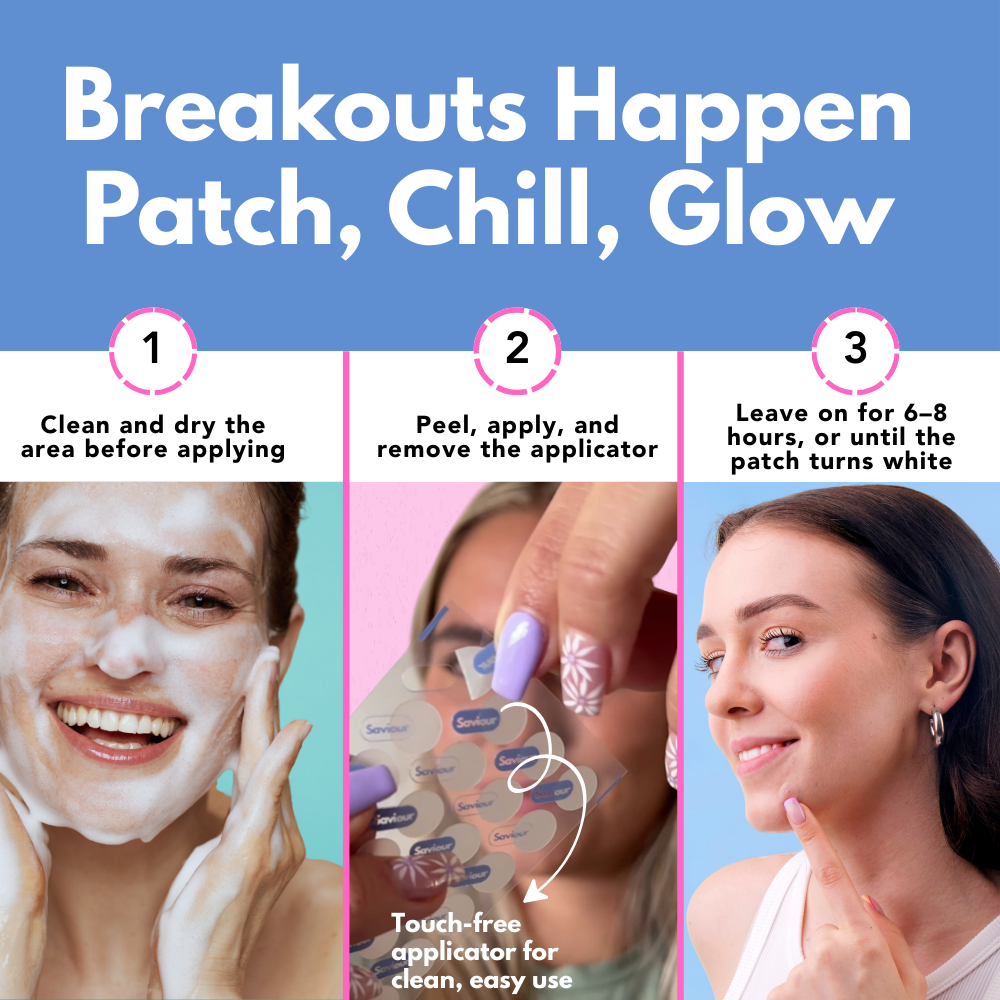 Top hydrocolloid spot patches for daily healing – apply Spot Saviour 96-pack with clean, effective steps