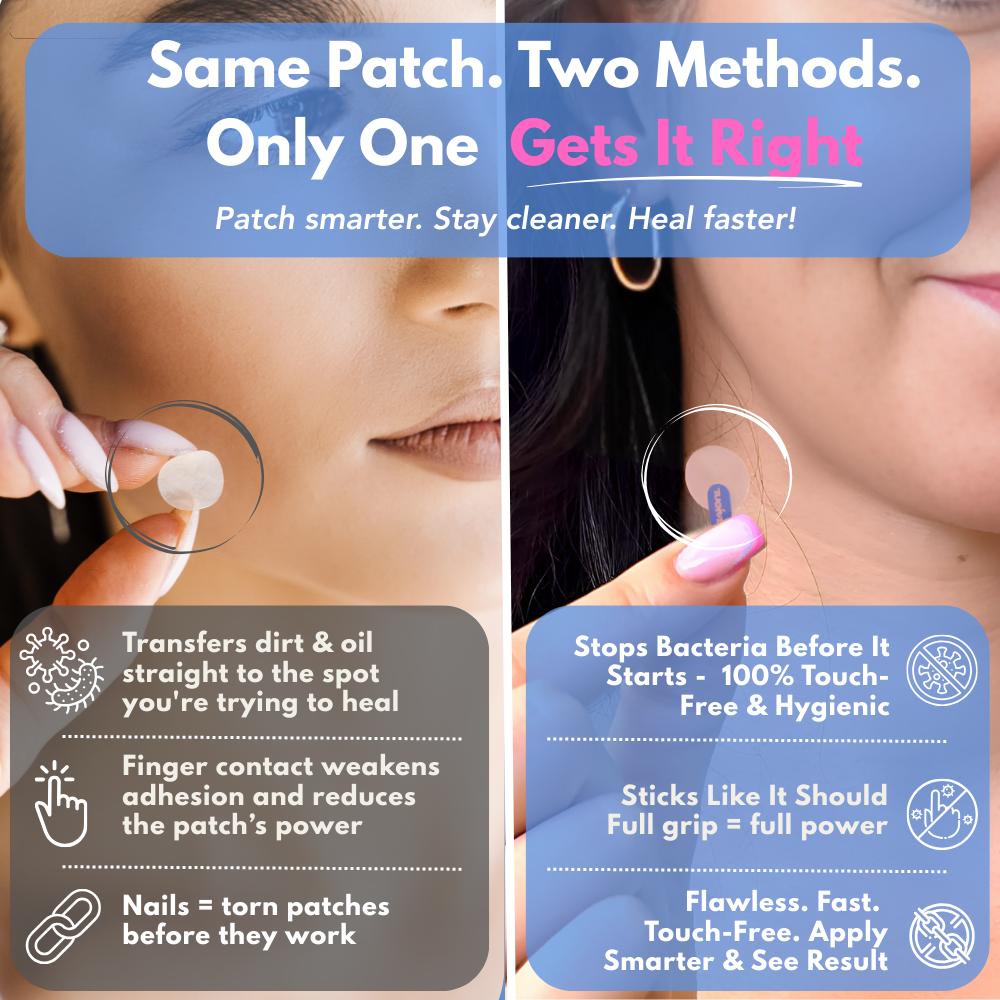 Visual comparison of hygiene – Spot Saviour 96-pack vs regular acne patch methods